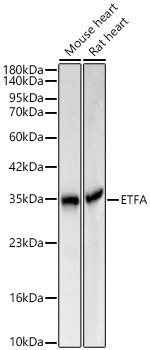 ETFA Rabbit Polyclonal Antibody