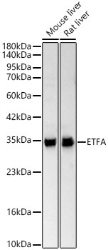 ETFA Rabbit Polyclonal Antibody - Image 2