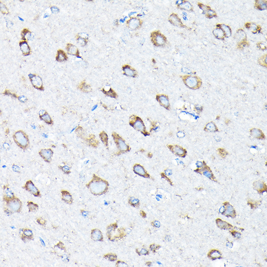 ETFA Rabbit Polyclonal Antibody - Image 3