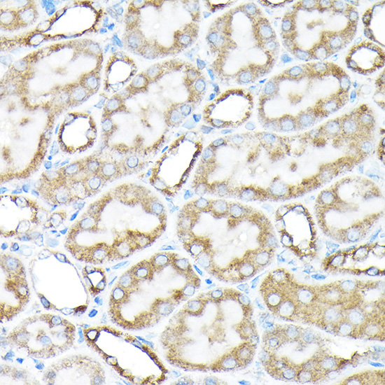 ETFA Rabbit Polyclonal Antibody - Image 4