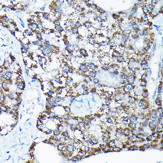 ETFA Rabbit Polyclonal Antibody - Image 5