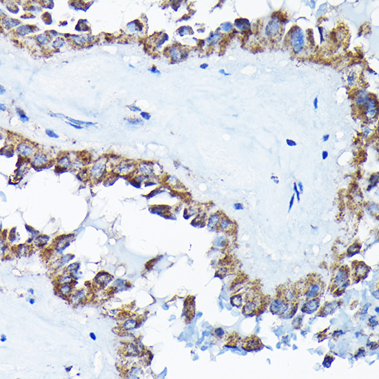 ETFA Rabbit Polyclonal Antibody - Image 6