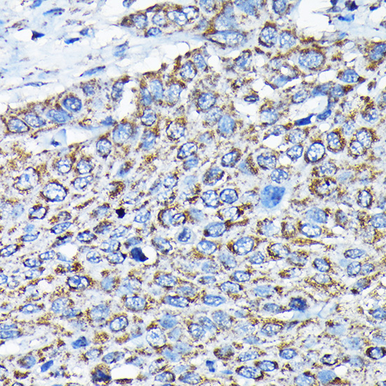 ETFA Rabbit Polyclonal Antibody - Image 7