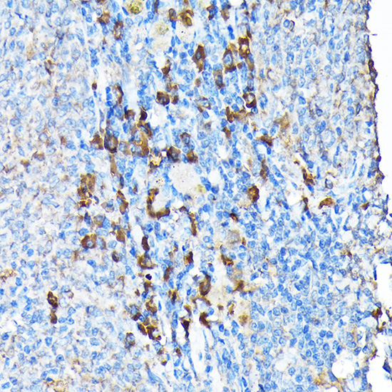 ETFA Rabbit Polyclonal Antibody - Image 8