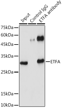 ETFA Rabbit Polyclonal Antibody - Image 9