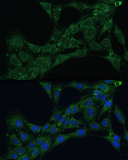 ETFB Rabbit Polyclonal Antibody - Image 2