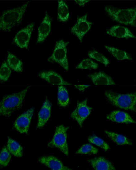 ETFB Rabbit Polyclonal Antibody - Image 3