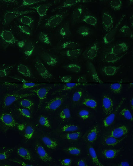 ETFB Rabbit Polyclonal Antibody - Image 4