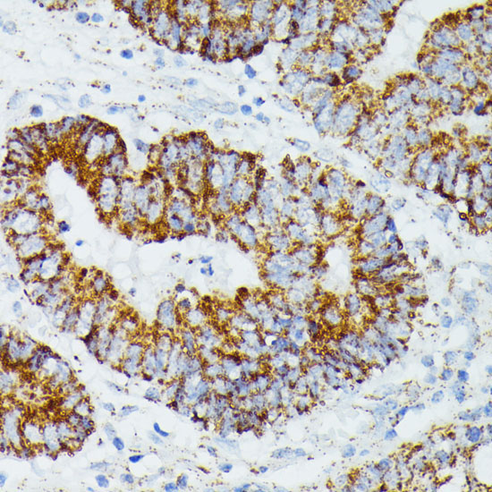 ETHE1 Rabbit Polyclonal Antibody - Image 3