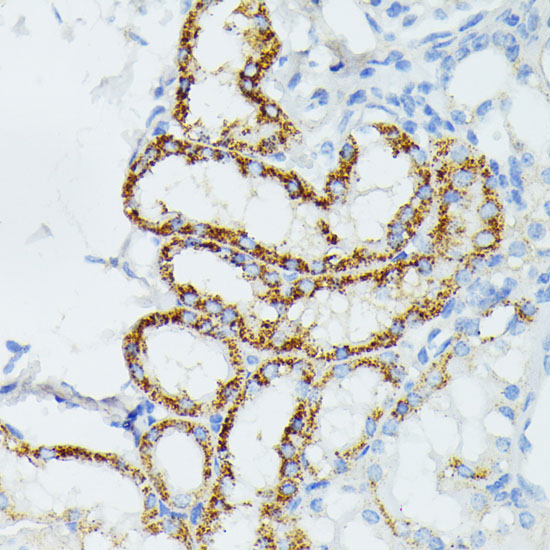 ETHE1 Rabbit Polyclonal Antibody - Image 4