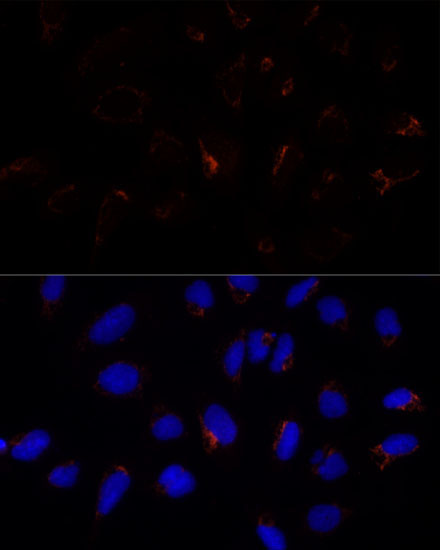 ETHE1 Rabbit Polyclonal Antibody - Image 5