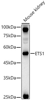 ETS1 Rabbit Polyclonal Antibody