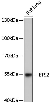 ETS2 Rabbit Polyclonal Antibody
