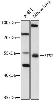 ETS2 Rabbit Polyclonal Antibody