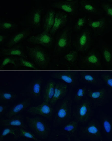 ETS2 Rabbit Polyclonal Antibody - Image 2