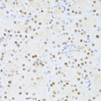 ETV1 Rabbit Polyclonal Antibody