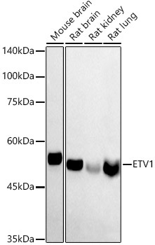 ETV1 Rabbit Polyclonal Antibody