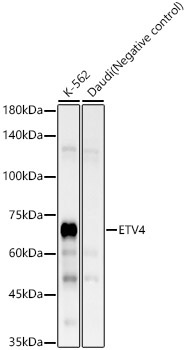 ETV4 Rabbit Monoclonal Antibody