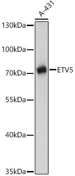 ETV5 Rabbit Polyclonal Antibody