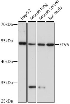 ETV6 Rabbit Polyclonal Antibody