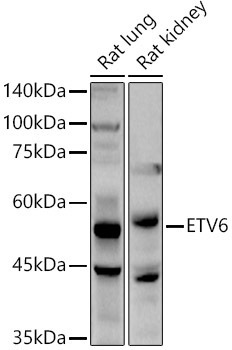 ETV6 Rabbit Polyclonal Antibody - Image 2