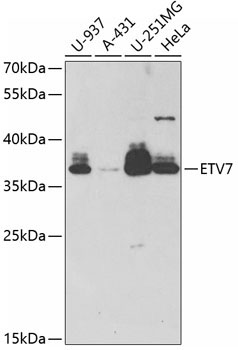 ETV7 Rabbit Polyclonal Antibody