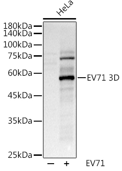 EV71 3D Rabbit Polyclonal Antibody