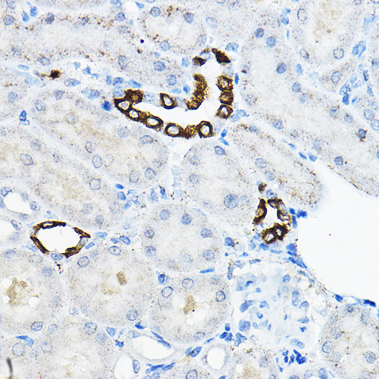 EVA1A Rabbit Polyclonal Antibody - Image 2