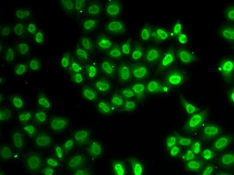EWSR1 Rabbit Polyclonal Antibody