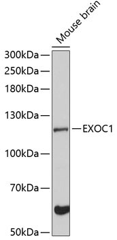 EXOC1 Rabbit Polyclonal Antibody - Image 2