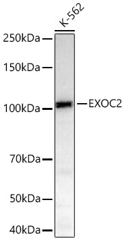 EXOC2 Rabbit Monoclonal Antibody