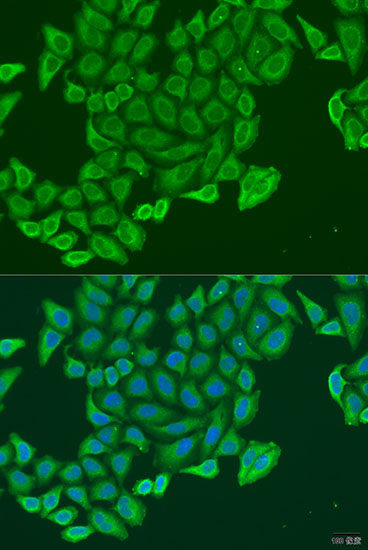 EXOC2 Rabbit Polyclonal Antibody - Image 2