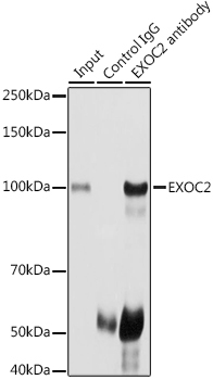 EXOC2 Rabbit Polyclonal Antibody - Image 3