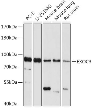 EXOC3 Rabbit Polyclonal Antibody
