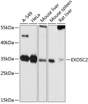 EXOSC2 Rabbit Polyclonal Antibody