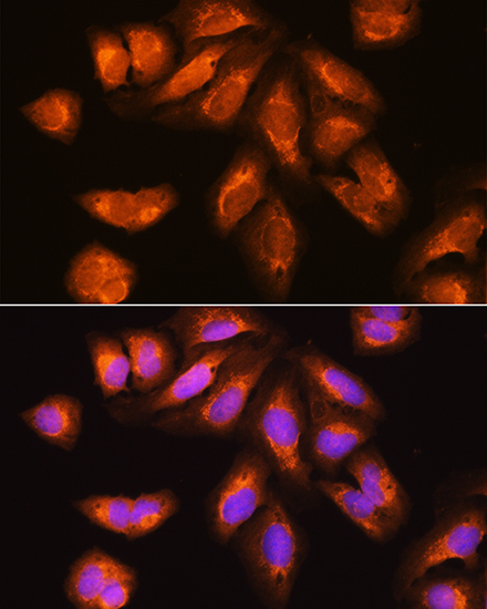 EXOSC2 Rabbit Polyclonal Antibody - Image 2