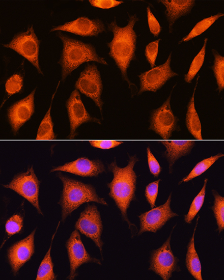EXOSC2 Rabbit Polyclonal Antibody - Image 3