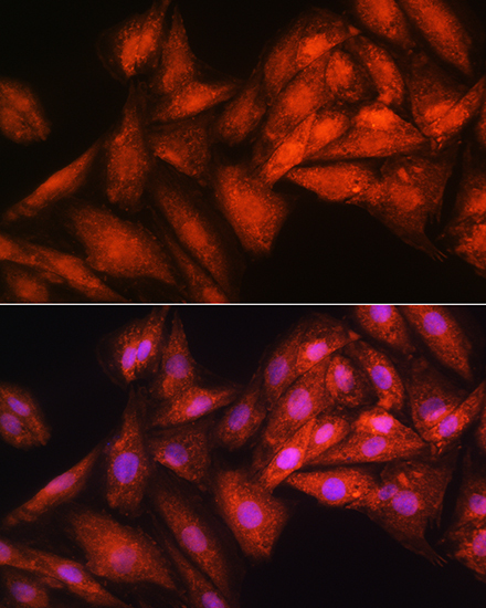 EXOSC2 Rabbit Polyclonal Antibody - Image 4
