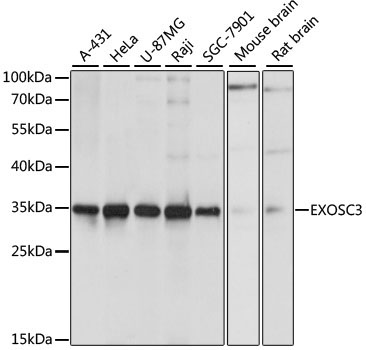 EXOSC3 Rabbit Polyclonal Antibody