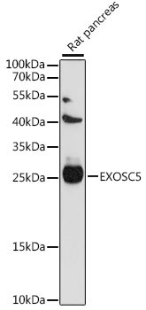 EXOSC5 Rabbit Polyclonal Antibody