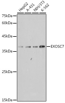 EXOSC7 Rabbit Monoclonal Antibody