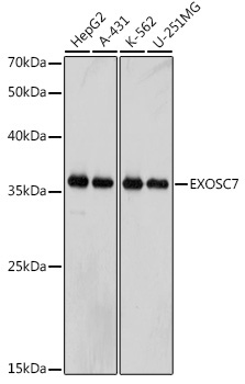 EXOSC7 Rabbit Monoclonal Antibody