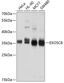 EXOSC8 Rabbit Polyclonal Antibody
