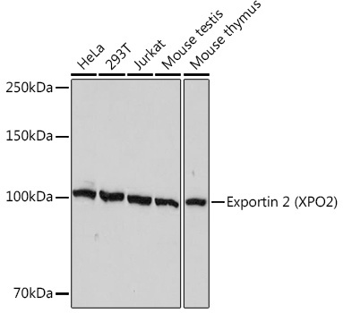 Exportin 2 (XPO2) Rabbit Monoclonal Antibody