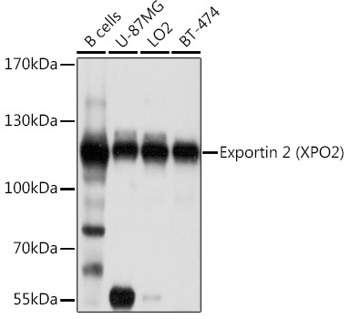 Exportin 2 (XPO2) Rabbit Polyclonal Antibody