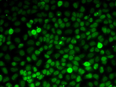 Exportin 5 (XPO5) Rabbit Polyclonal Antibody - Image 2