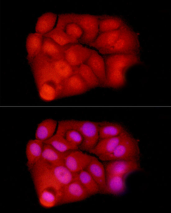 Exportin 5 (XPO5) Rabbit Polyclonal Antibody - Image 3