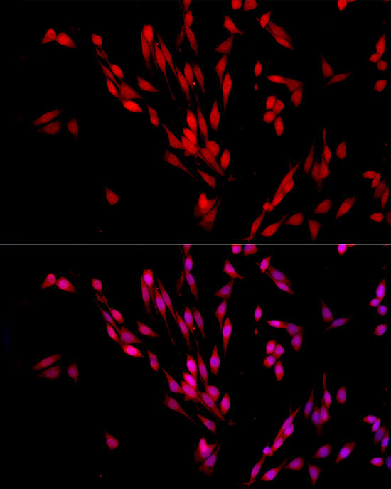 Exportin 5 (XPO5) Rabbit Polyclonal Antibody - Image 4