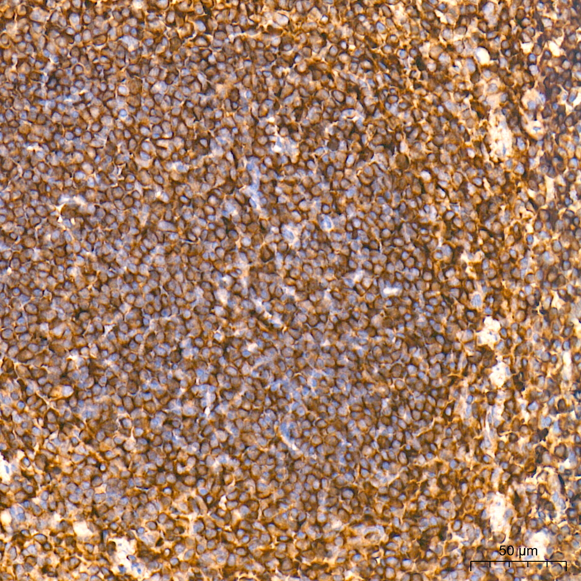 EXT1 Rabbit Polyclonal Antibody - Image 2