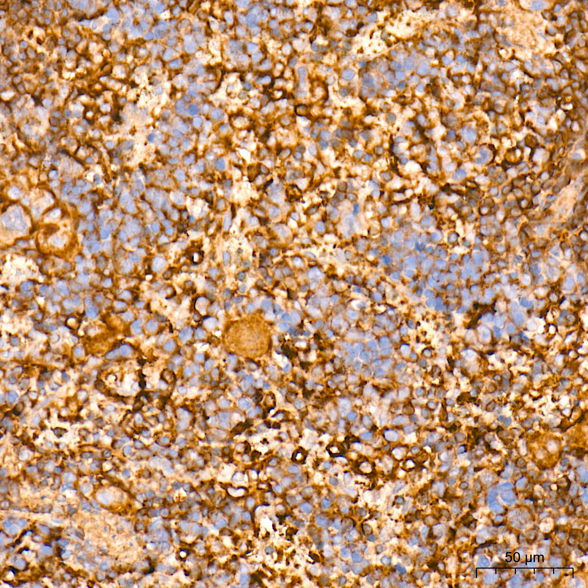 EXT1 Rabbit Polyclonal Antibody - Image 3